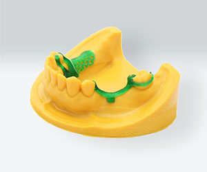 Dental Casting