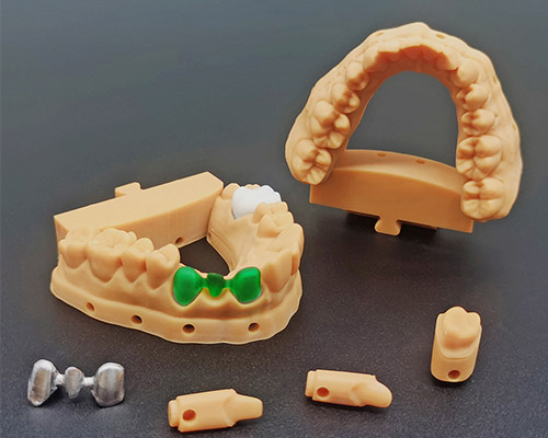 Casting Dental Model