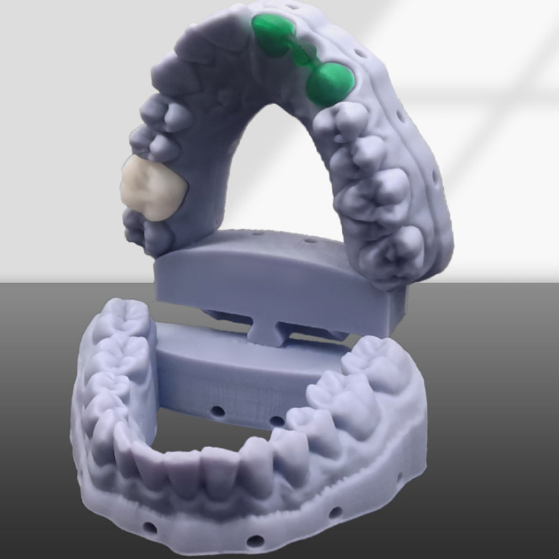 Dental casting