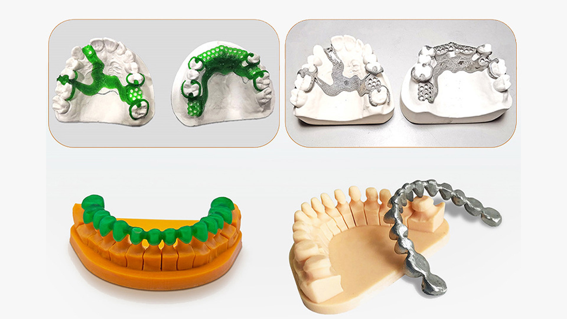 ACME 8K 10.1-inch dental 3D printing helps digital upgrade in the field of dental casting