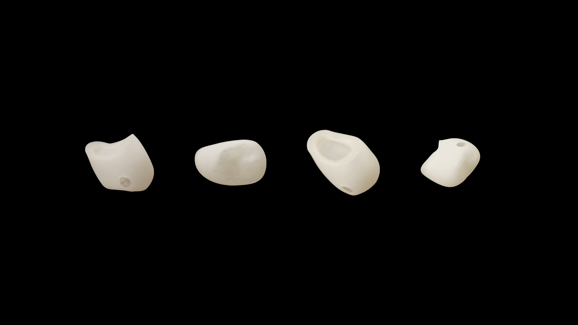 Which is better, 3D printed dental crown or traditional dental crown? What are the differences between 3D printed crowns and traditional crowns?